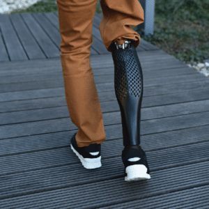 3D Printed Prosthetic Leg
