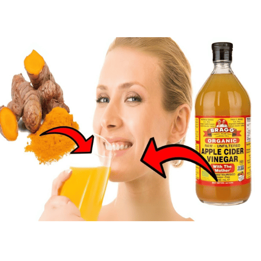 does apple cider vinegar help you lose weight 