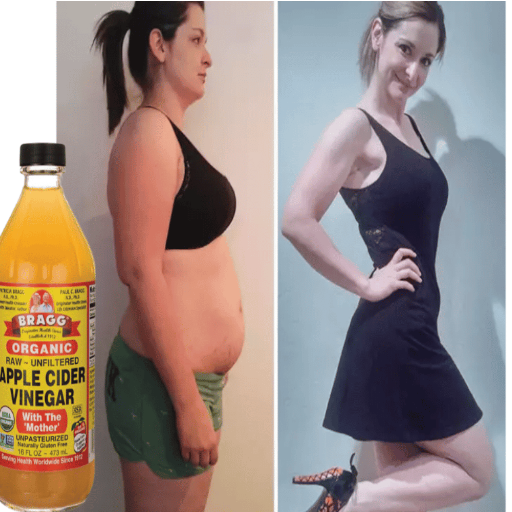 does apple cider vinegar make you lose weight