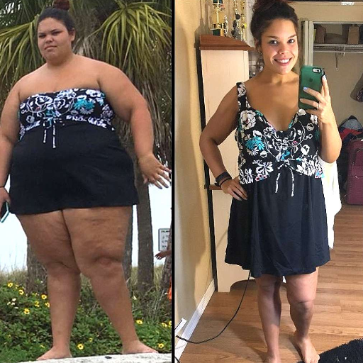 6 week belly ozempic weight loss before and after