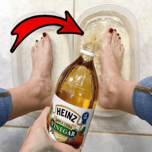 Apple Cider Vinegar on Feet for Weight Loss