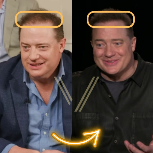 Brendan Fraser Weight Loss: Inspiring Transformation Journey