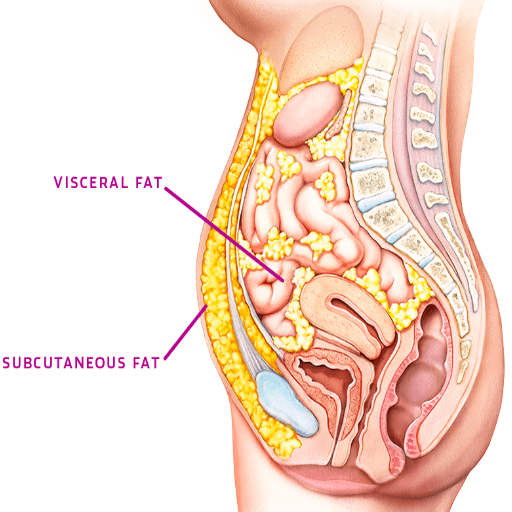 How does visceral fat differ from subcutaneous fat?