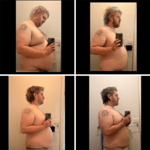 Ozempic Weight Loss Results