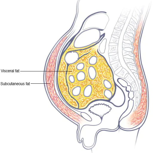 Why is Belly Fat a Major Health Concern?