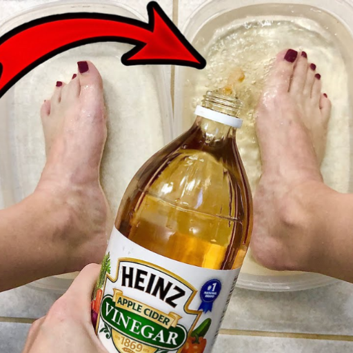 soaking feet in apple cider vinegar for lose weight