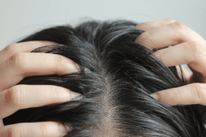 How to Get Rid of Greasy Hair Without Washing?