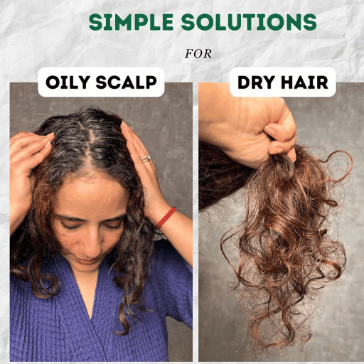 How to Get Rid of Greasy Hair Without Washing?